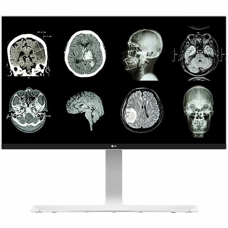 27IN LG MEDICAL IPS 8MP UHD 4K CLINICAL MONITOR, 3840X2160, HDMI DP USB, PIVOT H