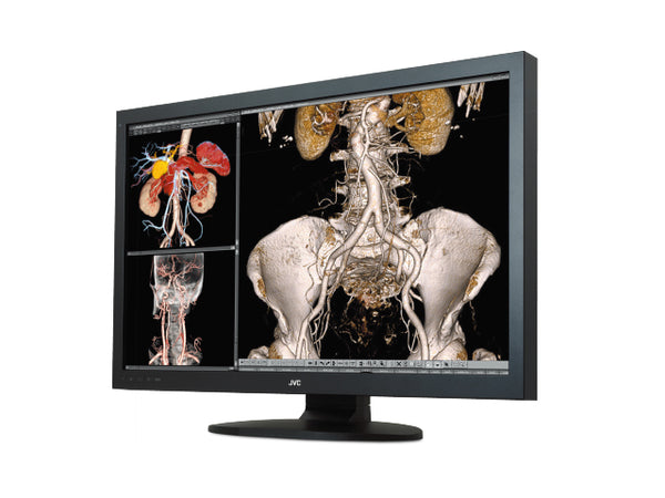 JVC CCL650i2 6MP 30-inch Medical Diagnostic Monitor – High Brightness & Precision Imaging