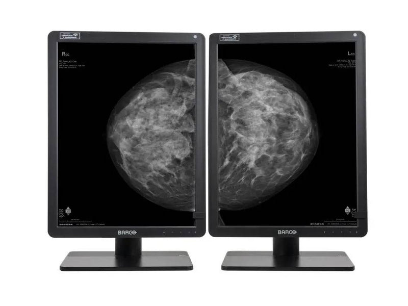 Barco Nio G 5.8MP MDNG-6221 Dual Diagnostic Monitors – DICOM Ready