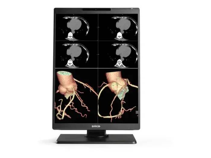 Barco Nio C 2MP MDNC-2521 21" Color Diagnostic Monitor – DICOM