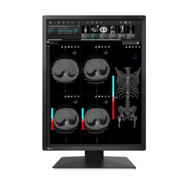 Eizo Ncnr Mx217-bk Eizo 21.3 Lcd Led Color Monitor With Dicom Calibration.