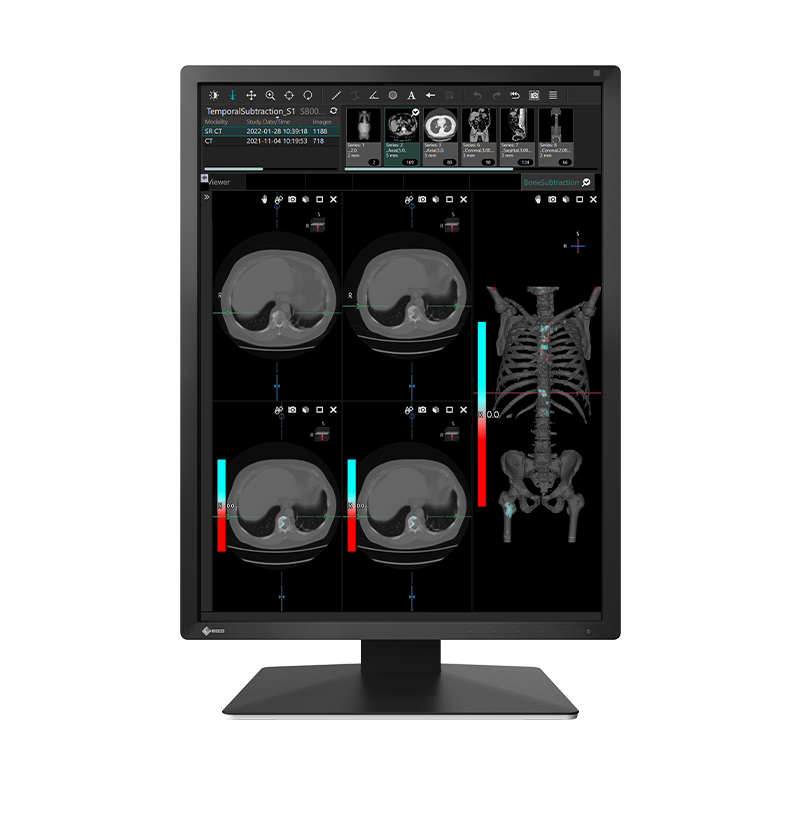 Eizo Ncnr Mx217-bk Eizo 21.3 Lcd Led Color Monitor With Dicom Calibration.