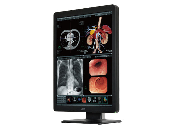 JVC CCL-R211 2MP 21.3" Medical Monitor – High Clarity & DICOM Ready