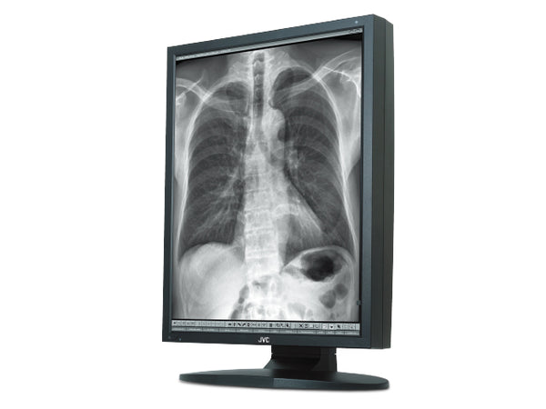 JVC MS35i2 3MP 21.3" Medical Monitor – High Precision & Clarity