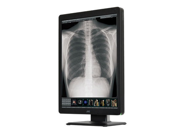 JVC CL-S300 3MP 21.3" Medical Monitor – High Clarity & DICOM Ready