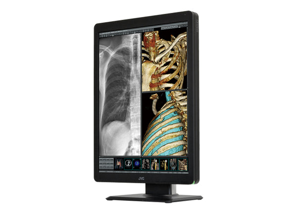 JVC CL-S200BF 2MP 21.3" Medical Monitor – High Clarity & DICOM Ready