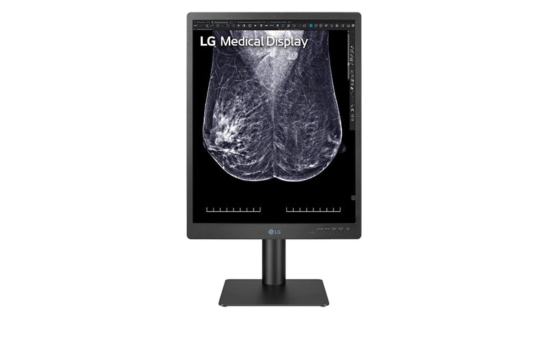 LG 21.3-inch 5MP IPS Diagnostic Monitor for Mammography